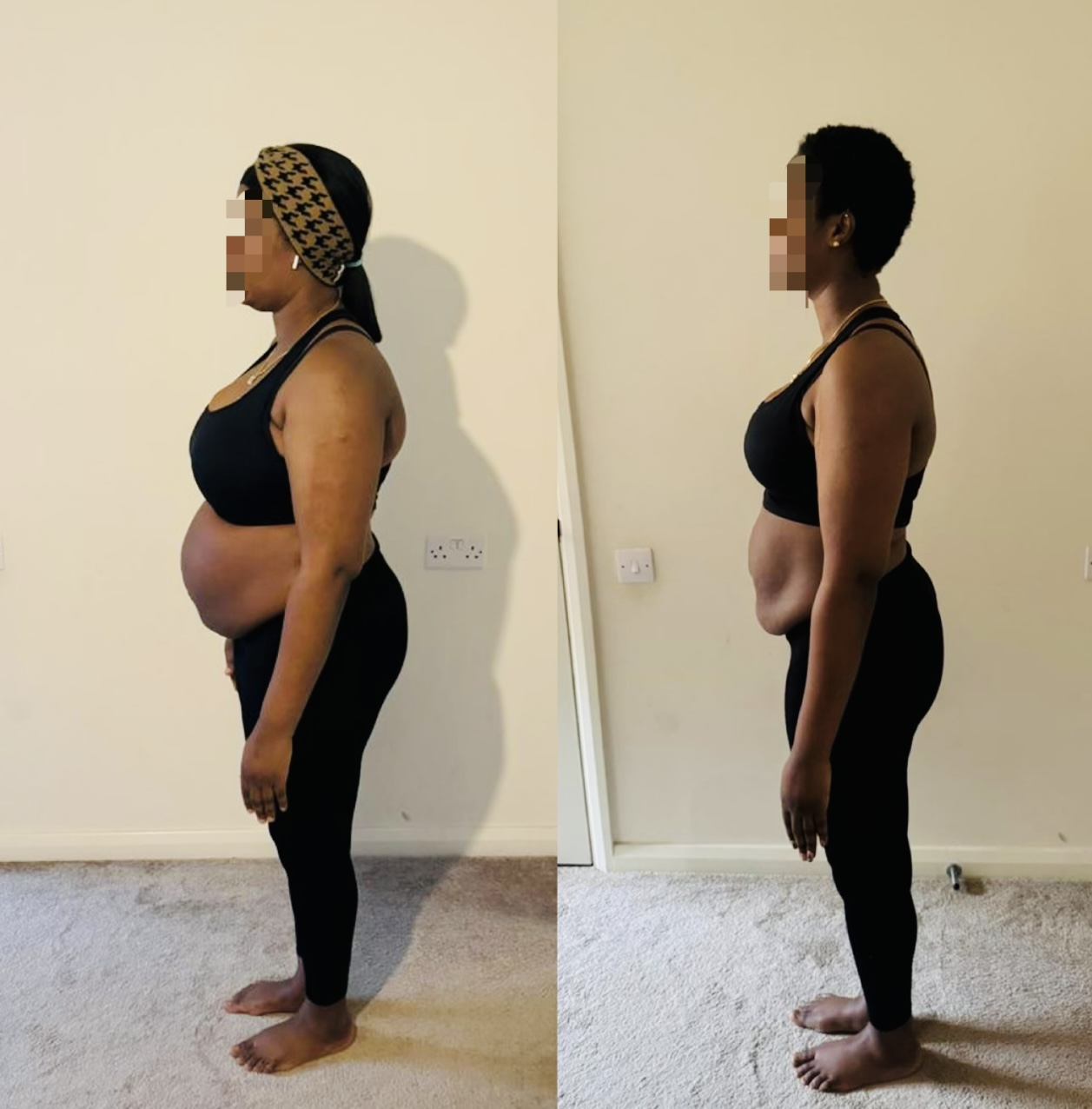 before and after - mybodyera (1)
