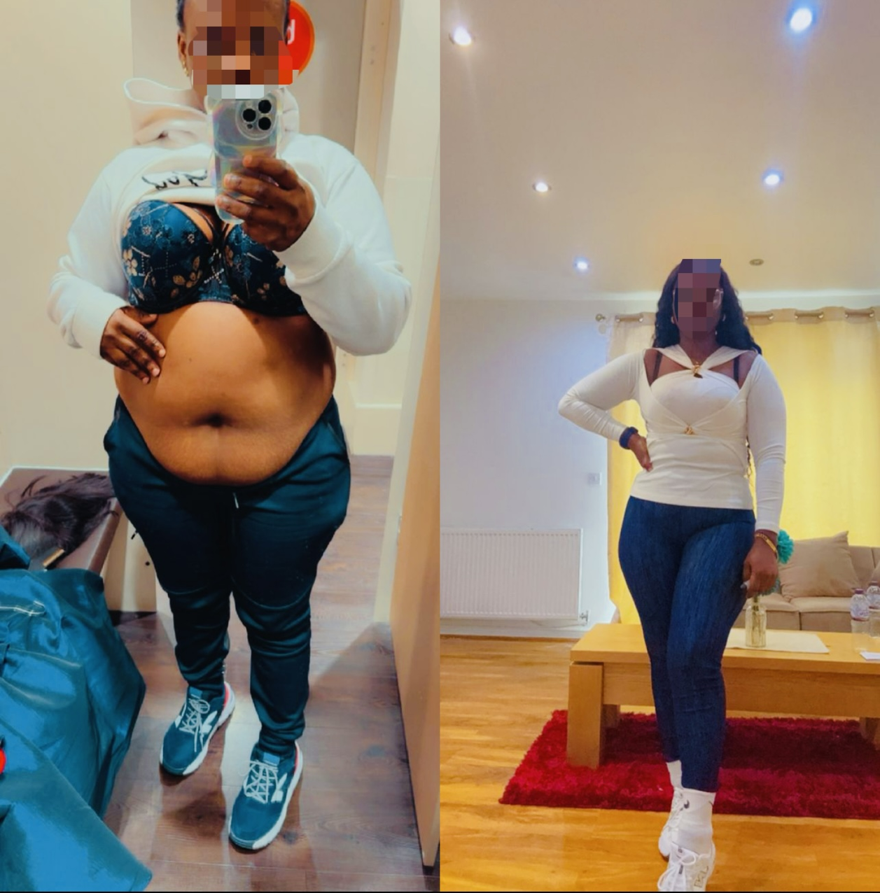 before and after - mybodyera (2)